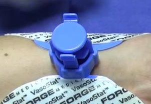 The VasoStat hemostasis device from Forge Medical